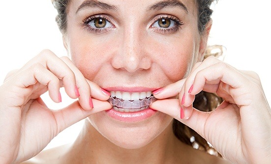 Woman placing Invisalign tray