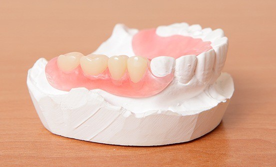 Model smile with partial denture