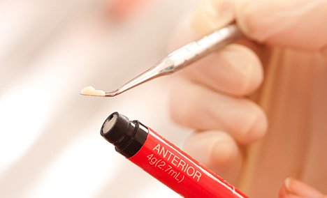 a tube of tooth-colored composite resin