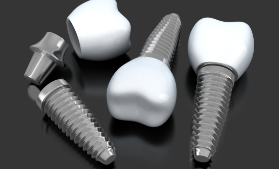 Three animated dental implants