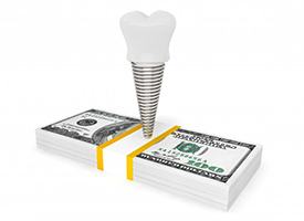 dental implant and crown on top of a stack of cash