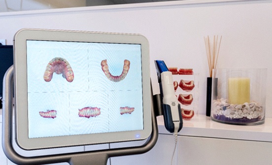 iTero scanner in Clinton Township showing 3D models of teeth