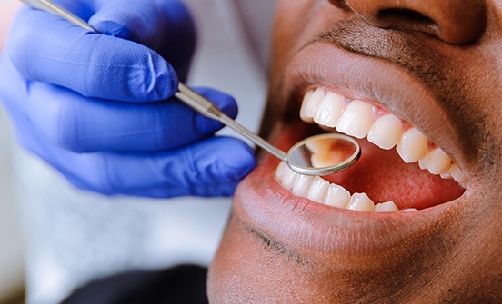 Man receiving dental exam