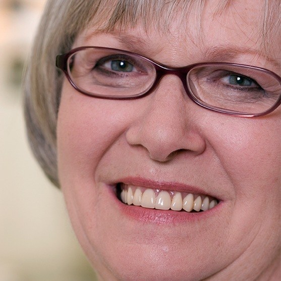 Woman showing healthy smile