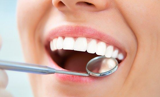 Closeup of smile during dental exam