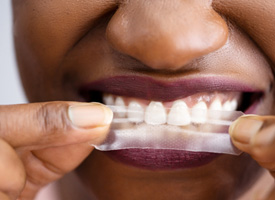 a woman putting a whitening strip on her teeth