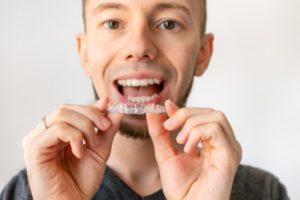 man with clear aligners